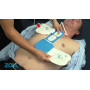 Zoll CPR-D padz for Zoll AED Plus