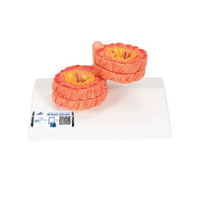 3B Scientific COPD bronchial tissue model