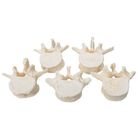 3B Scientific BONElike lumbar vertebrae model set (5 pcs)